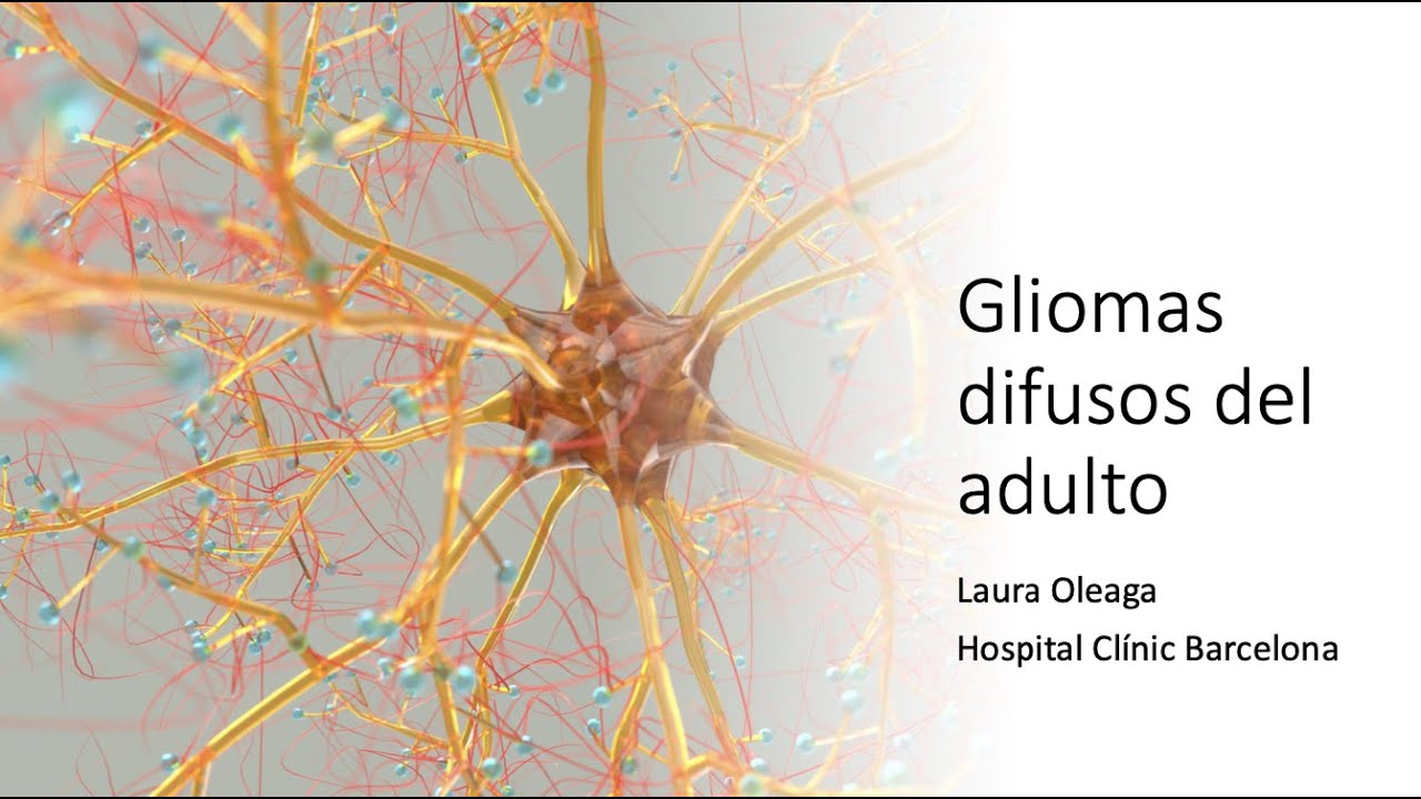 315- Gliomas difusos del adulto. Curso de Tumores del Sistema Nervioso Central.