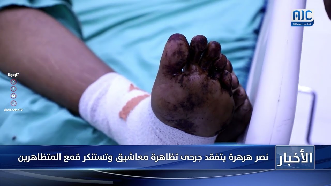 نصر هرهرة يتفقد جرحى تظاهرة معاشيق وتستنكر قمع المتظاهرين