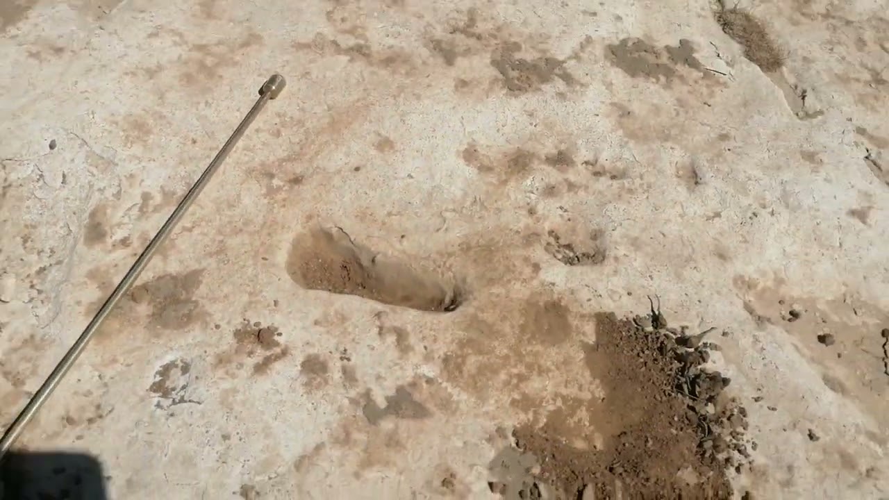 تحليل اشاره قدم الطفل بطريقه صحيحه ميدانيا (رجعنا للتحليل الميداني ) شاهد الحل الصحيح