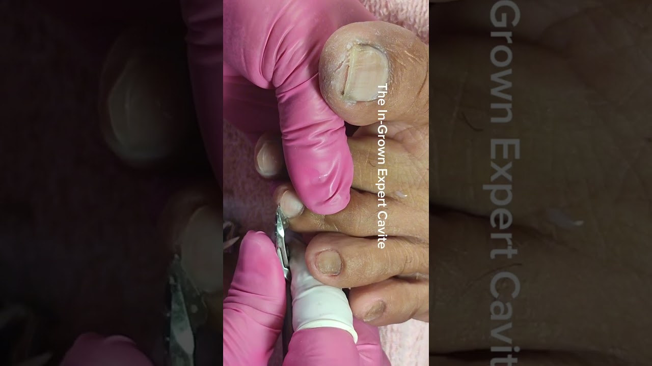 full video pedicure and dryskin removal