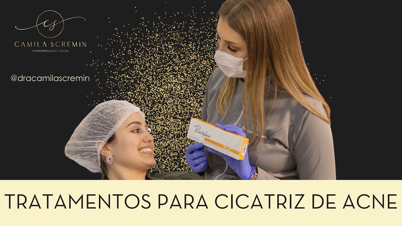 Live: Tratamentos para Cicatriz de Acne