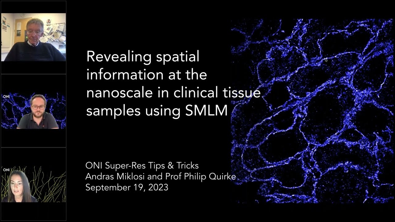 Revealing Spatial Information at the Nanoscale in Clinical Tissue Samples Using SMLM