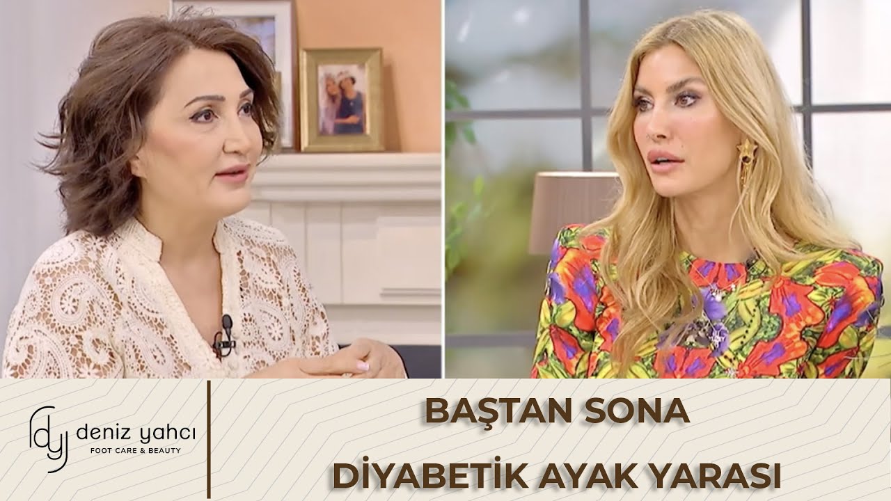 Diyabetik Ayak Yarası Tanı ve Tedavi Yöntemleri