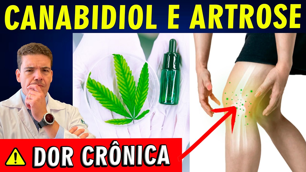 🟢 Canabidiol na Dor da Artrose: Cuidado Antes de Usar