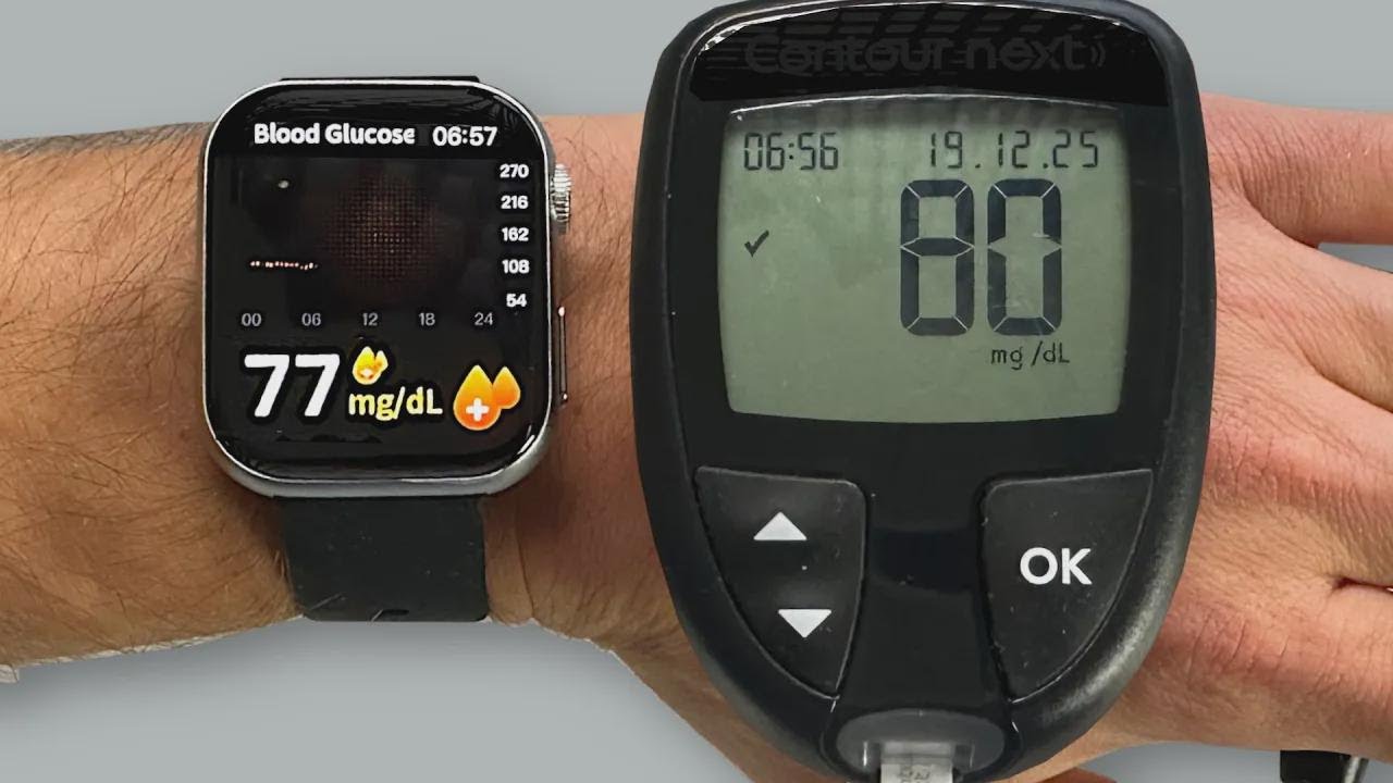 Smartwatch vs glucómetro: ¡No lo puedo creer!