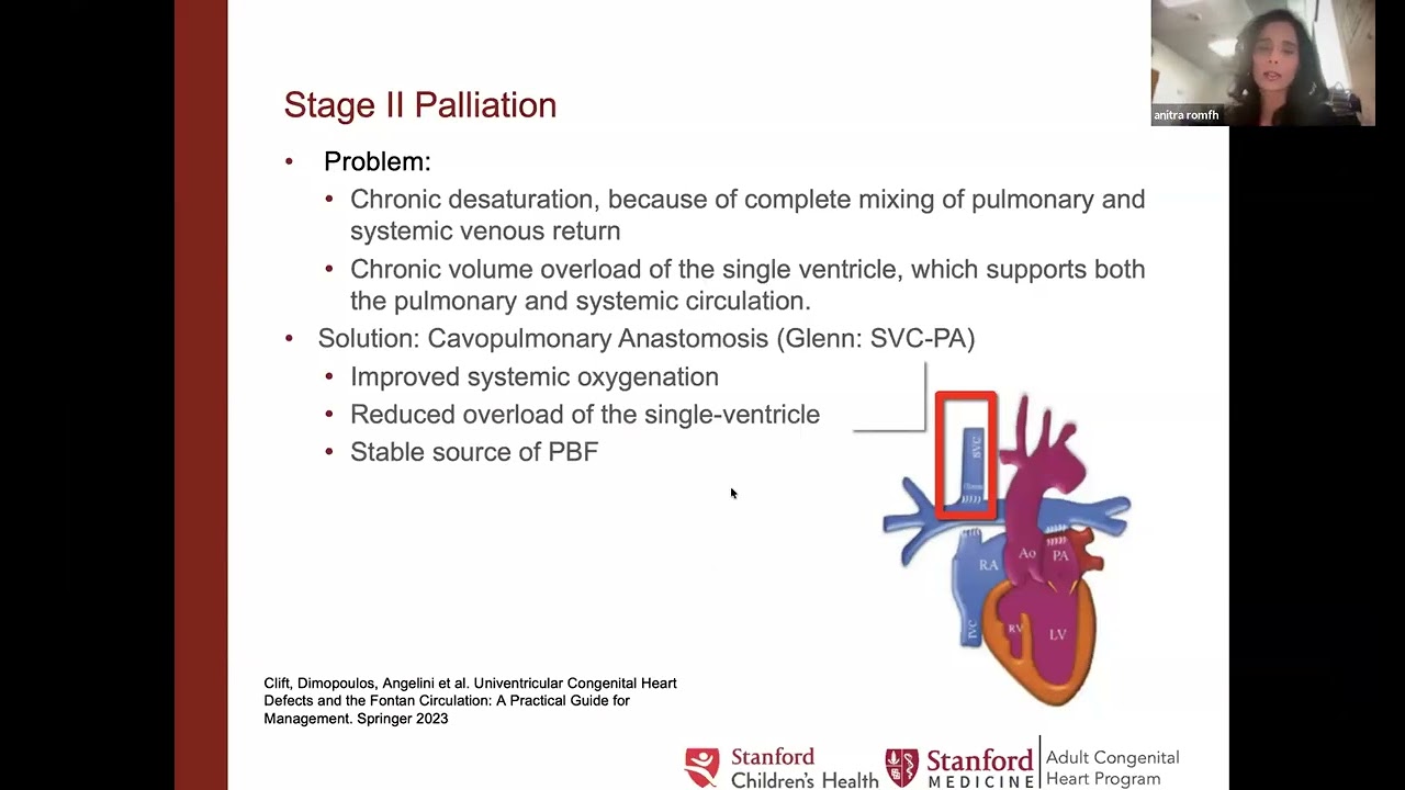 ISHLTv Webinar - The Basics of Fontan Failure in the Adult Patient (14 January, 2026)