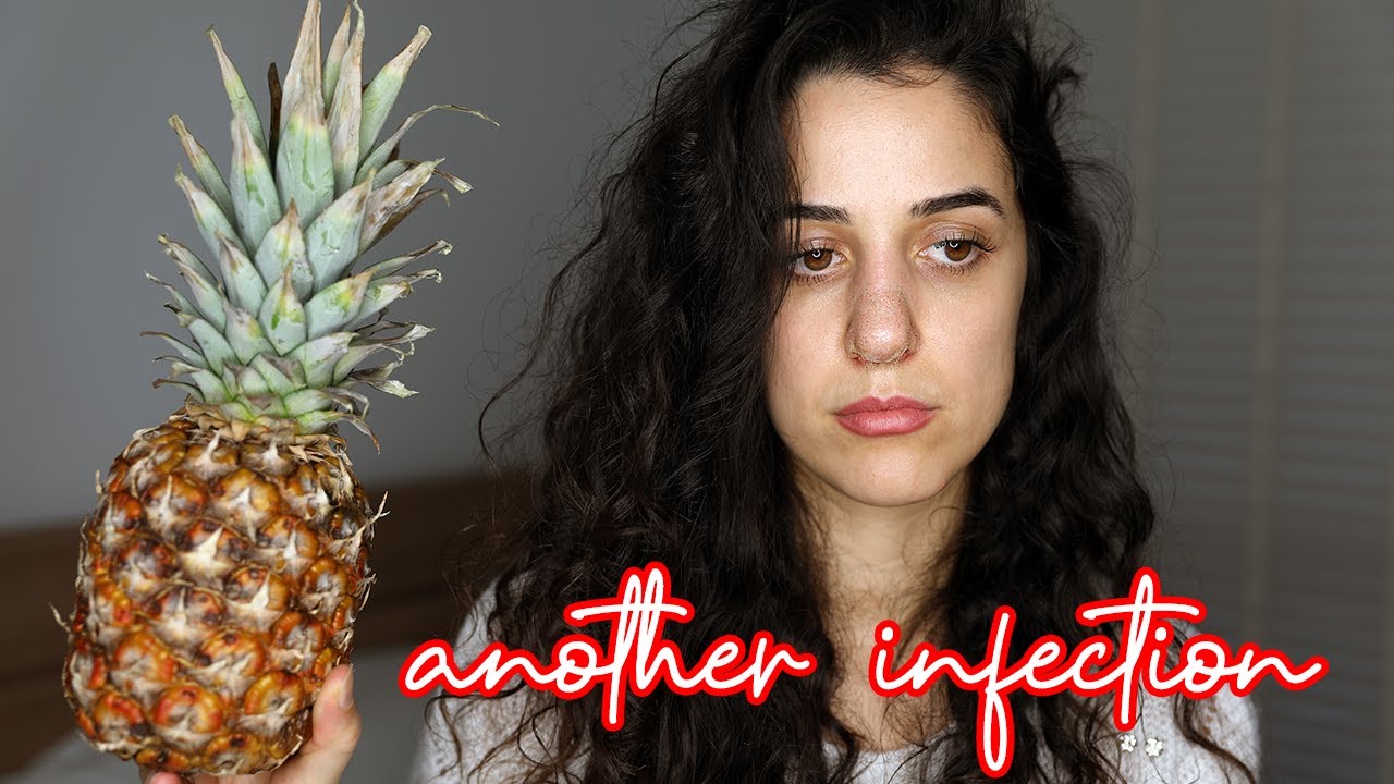 3 month nose job update | ANOTHER INFECTION *i dont trust anyone*