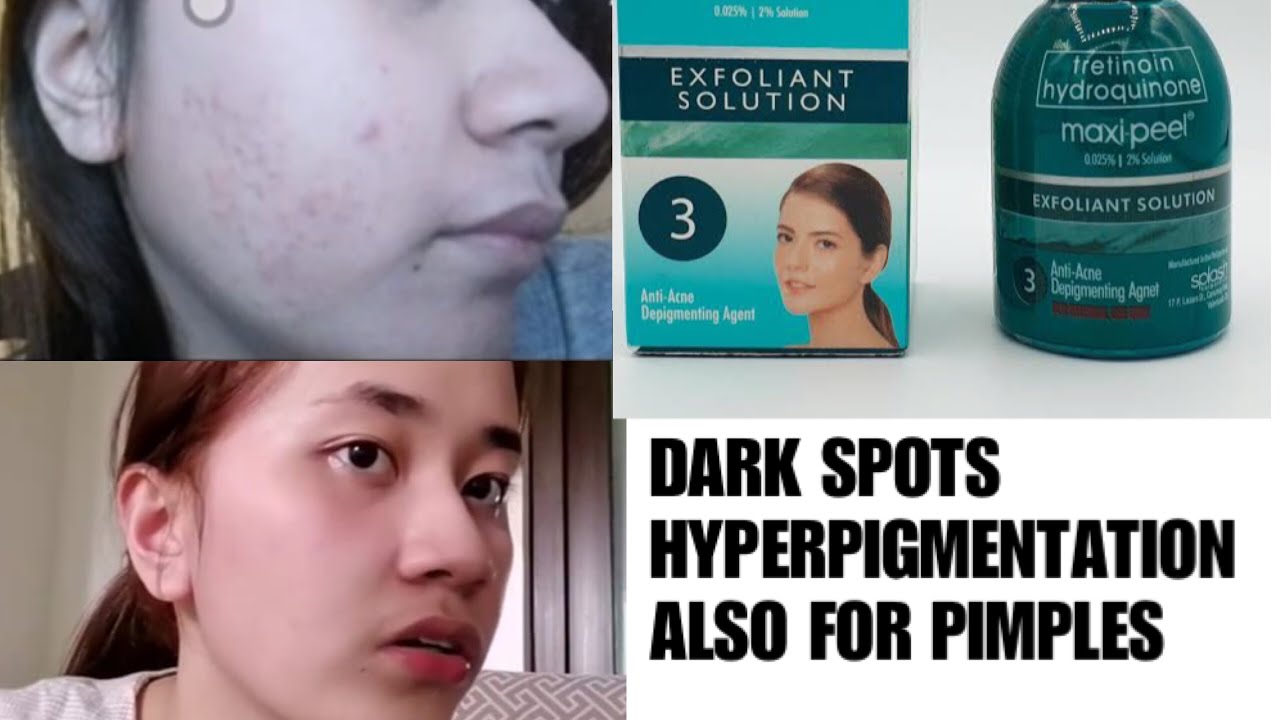 MAXIPEEL #3 FOR DARK SPOTS AND HYPERPIGMENTATION