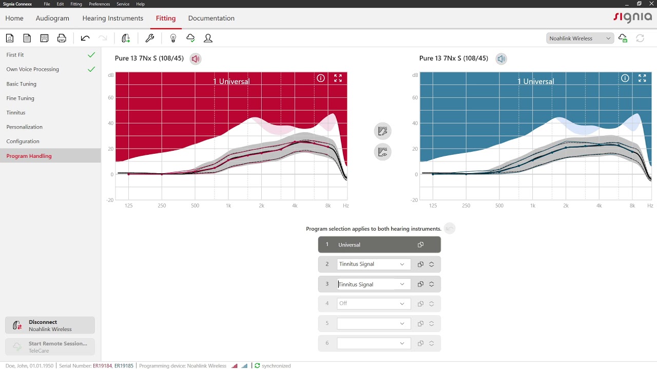 Setup listening programs in Connexx 9 | Signia Hearing Aids