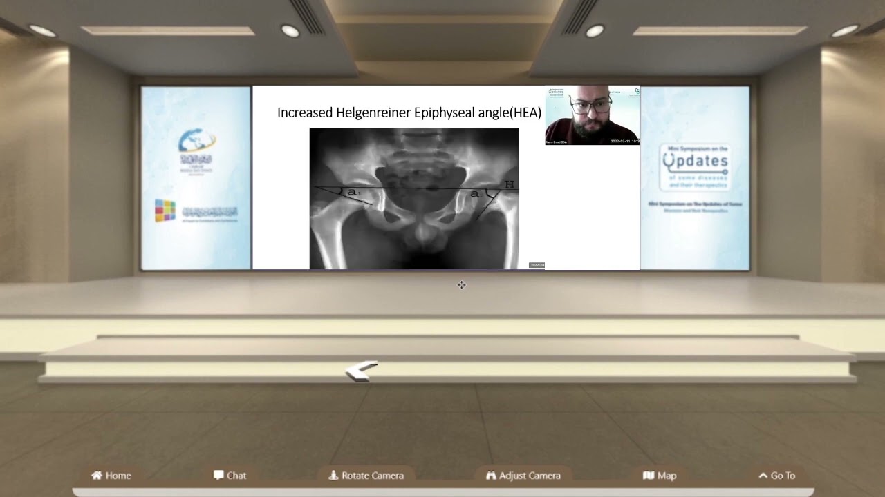Dr.Ramy Emad eldin Shalaby _ Treatment of coxa vara using monolateral external fixator