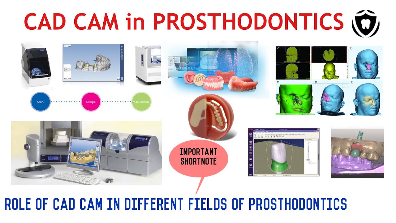 CAD-CAM IN PROSTHODONTICS