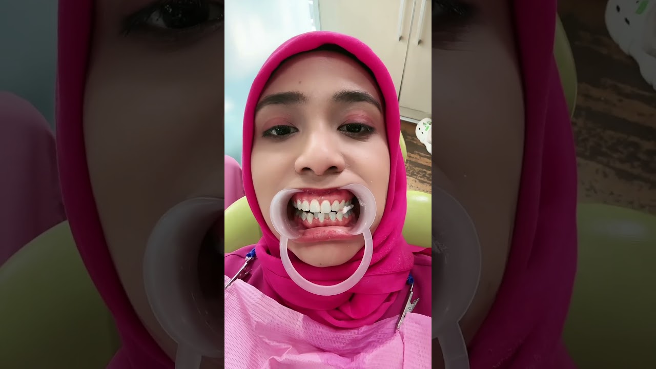 PASANG BEHEL KARNA HUJATAN NETIJEN⁉️