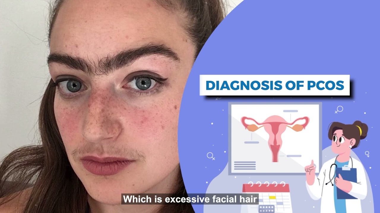 Polycystic Ovary Syndrome &ndash; Causes, Symptoms & Treatment
