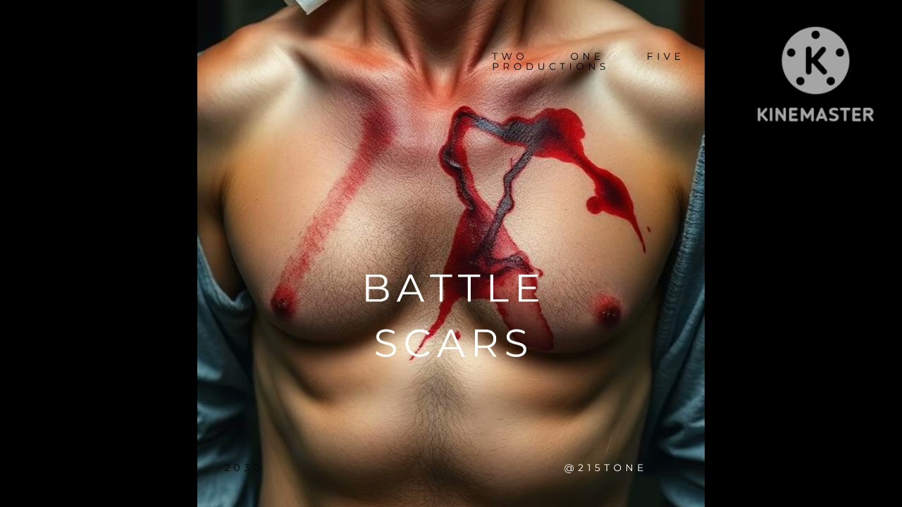 Battle scars
