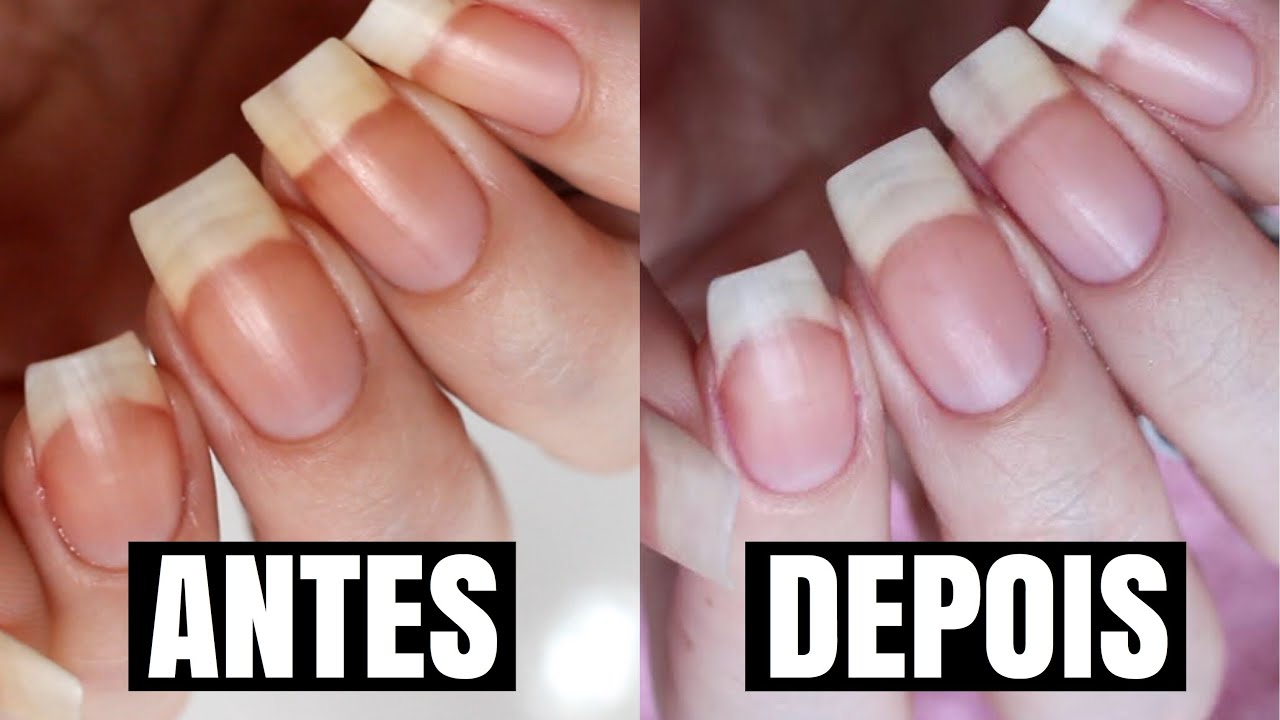 COMO TIRAR O AMARELO DAS UNHAS