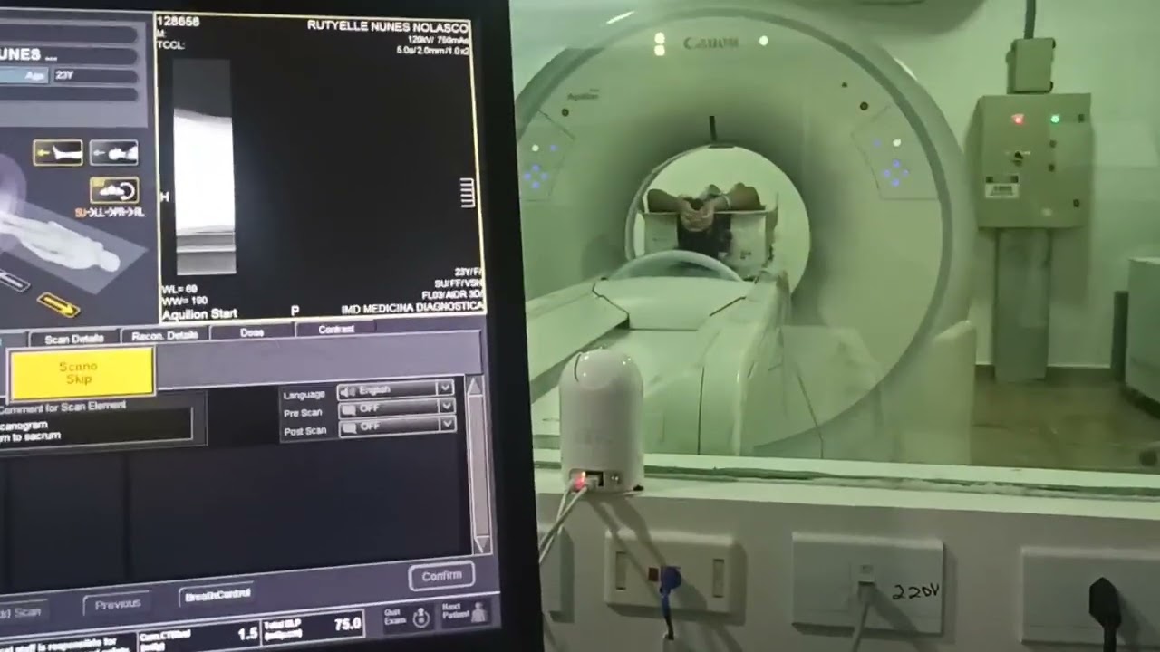 Aquisição de TC de Coluna Lombar em equipamento Canon Aquilion Start
