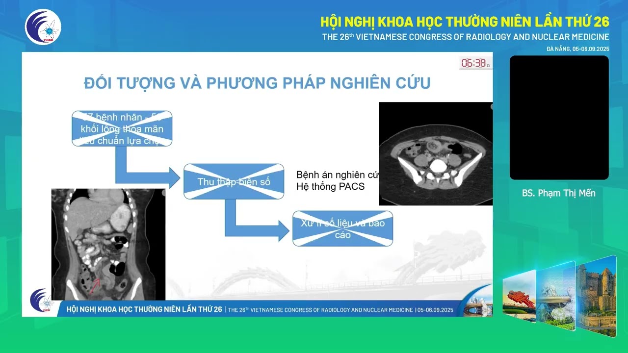 1. Vai trò CT trong chẩn đoán nguyên nhân và biến chứng lồng ruột người lớn (ThS.BS. Phạm Thị Mến)