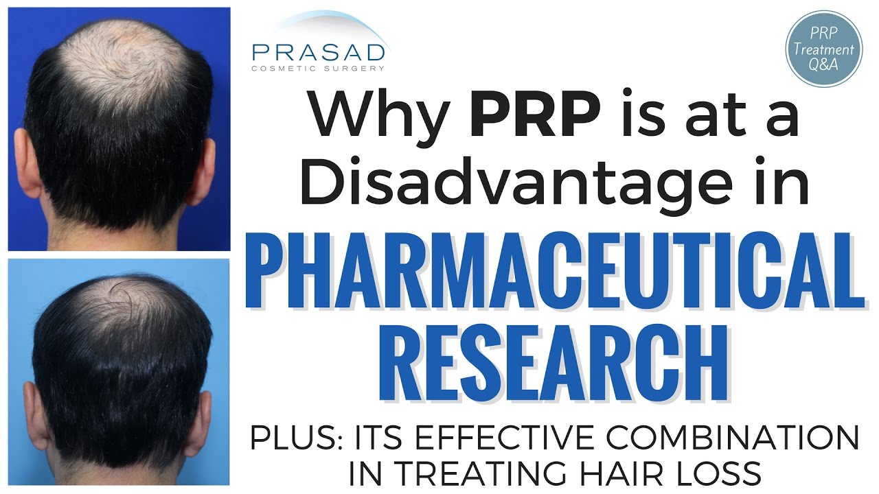 Why PRP for Hair Loss is Not Well Publicized, and Increased Effectiveness When Combined