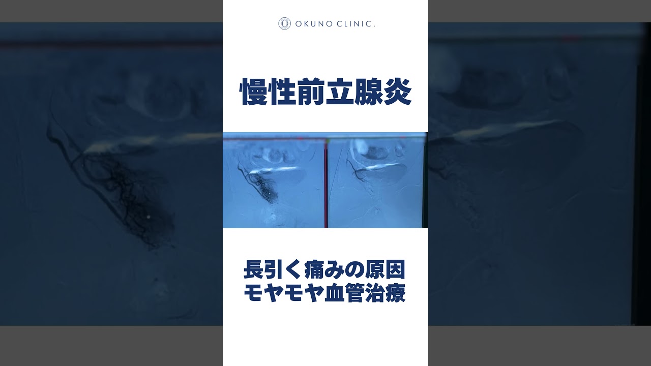 慢性前立腺炎 モヤモヤ血管治療　#オクノクリニック