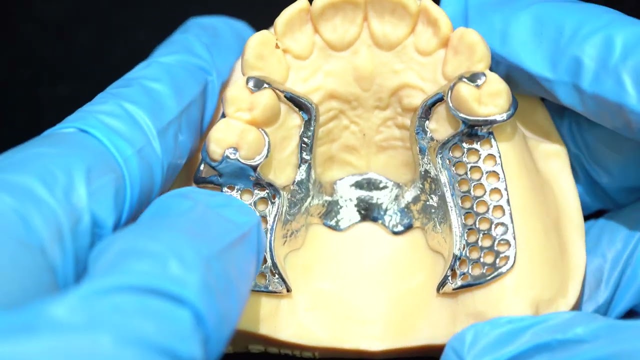Metal Alloys Partial Cobalt Chrome Dentures Ivoclar Scheftner Comfortable China Dental Lab