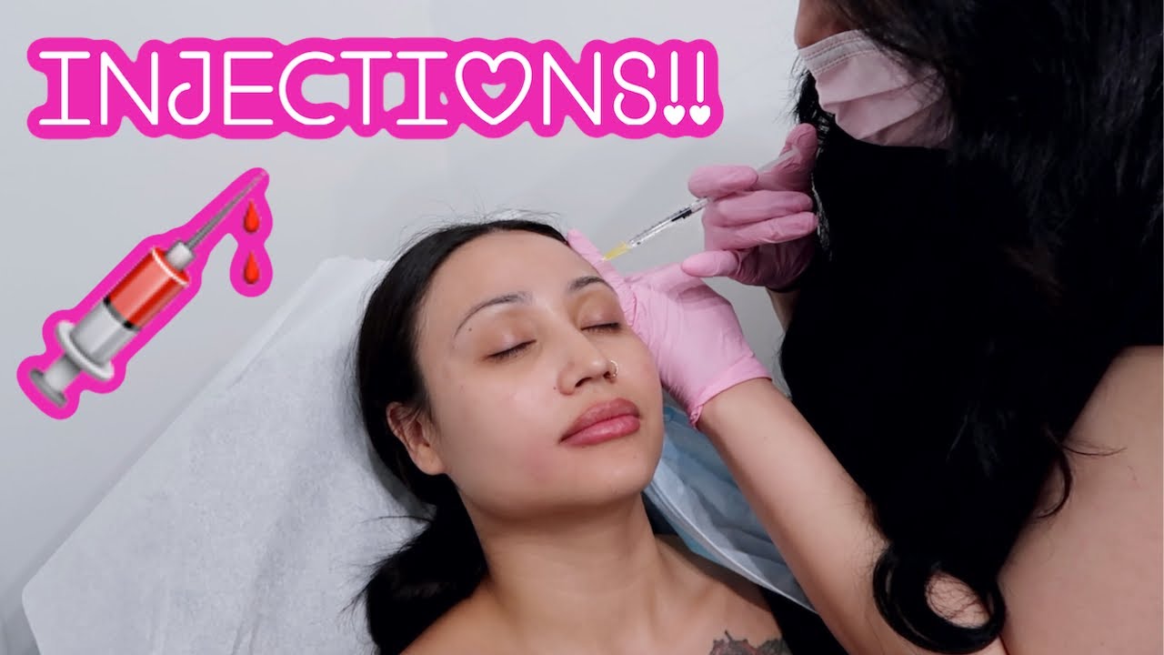 GETTING FILLERS & BOTOX!!