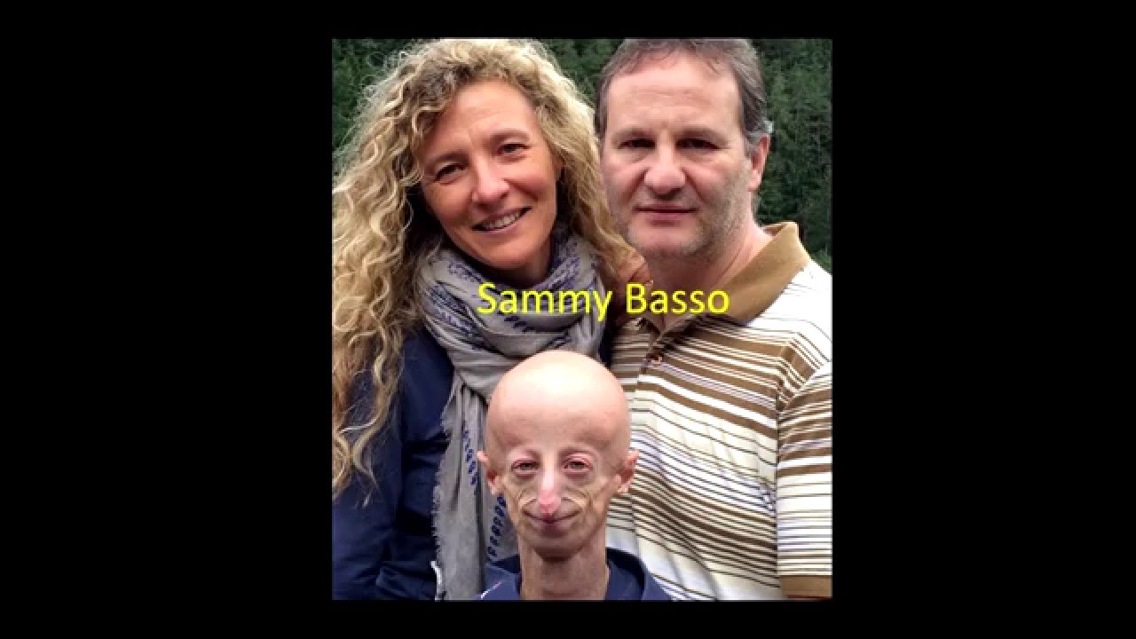 Come trasformare la disabilità in forza produttiva! | Sammy Basso | TEDxLecce