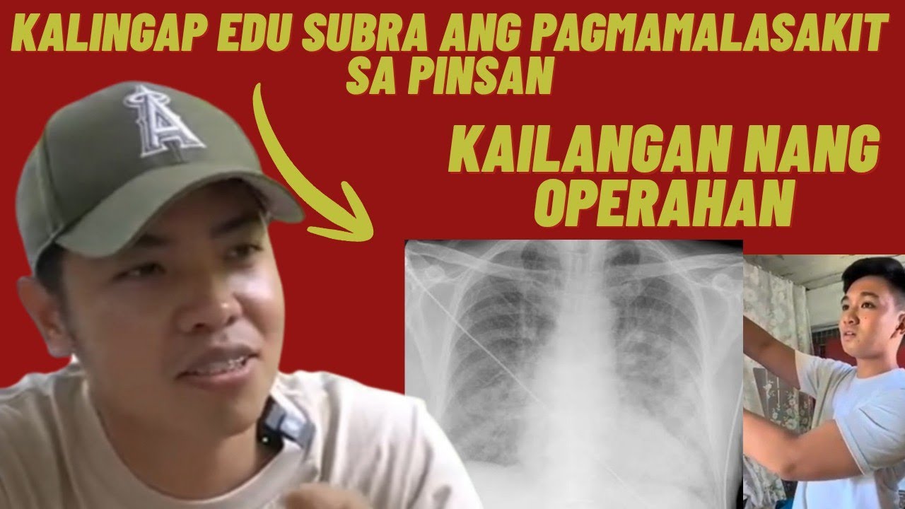 VLOG NI KALINGAP EDS SAMPAL SA MUKHA NG BASHER..PINSAN NI KALINGAP EDU KAILANGAN NANG OPERAHAN?