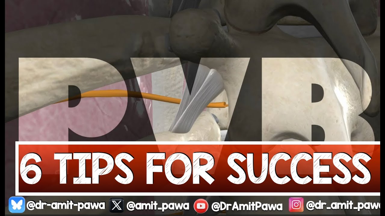 PVB UPDATE  - Tips for Success