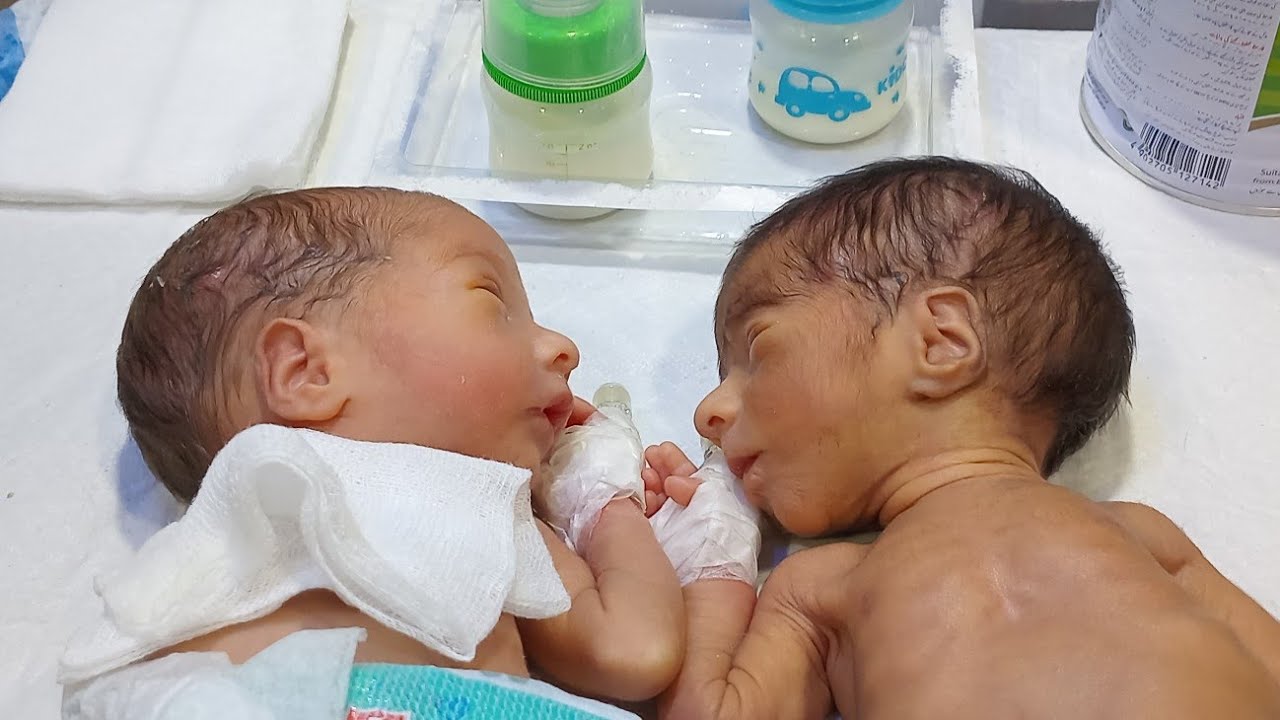 Part 2 | Premature Baby in NICU with Warmer Therapy Care 😍 Preterm Baby Recovery___# DailyUpdate..