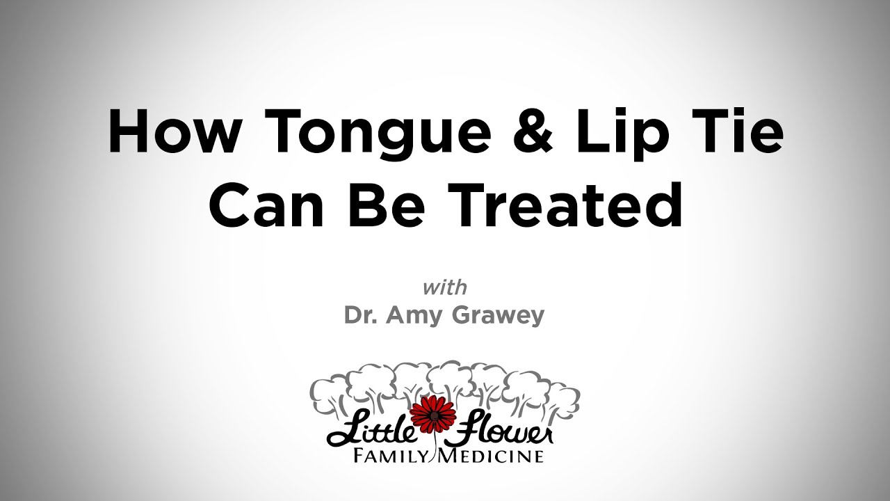 How Tongue & Lip Tie Can Be Treated
