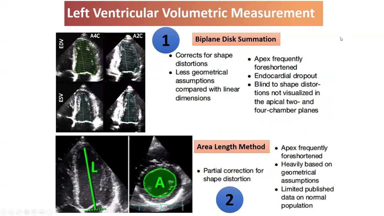 ASE 2021 Quantitation of Left heart