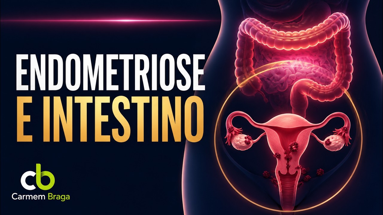 Endometriose e Alimentação - O que não contaram pra você!