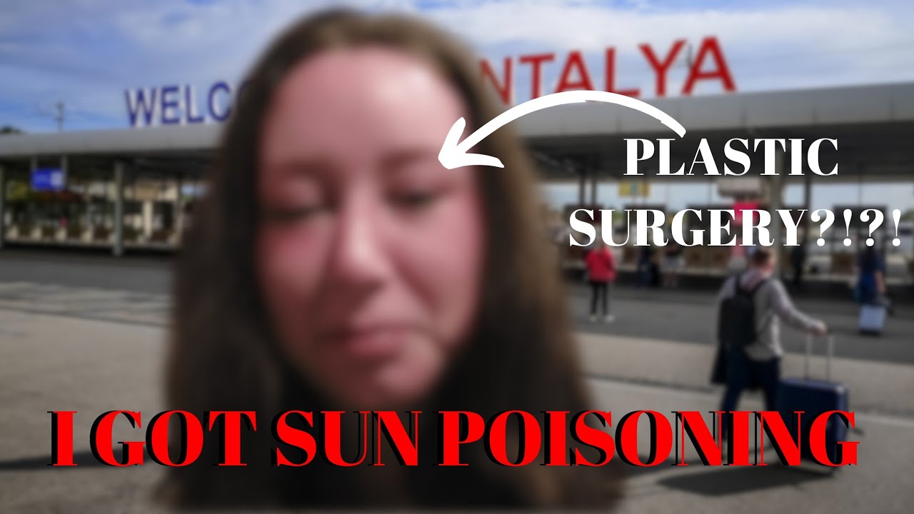 I GOT SUN POISONING IN ANTALYA/FLYING BACK TO ENGLAND/DELAYED FLIGHT/ANTALYA VLOG FINALE