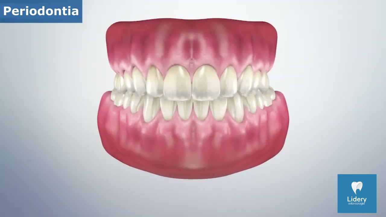 O que &eacute; Periodontia ?