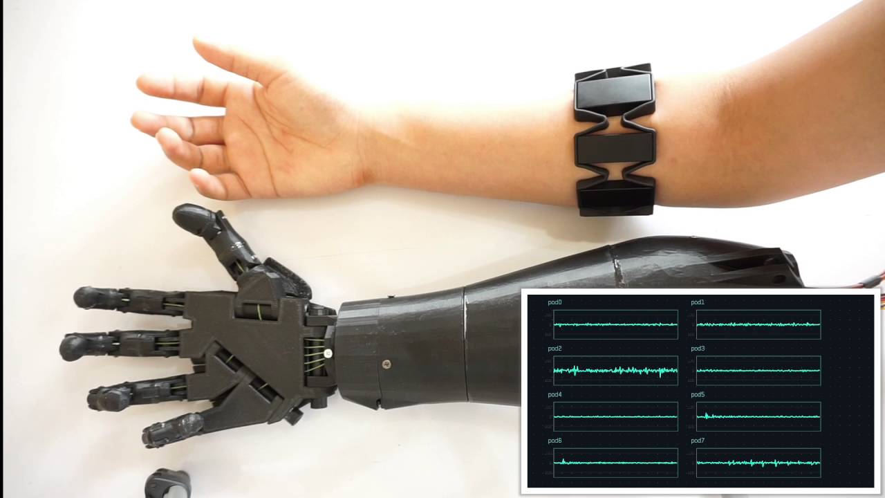 Myoelectric Control