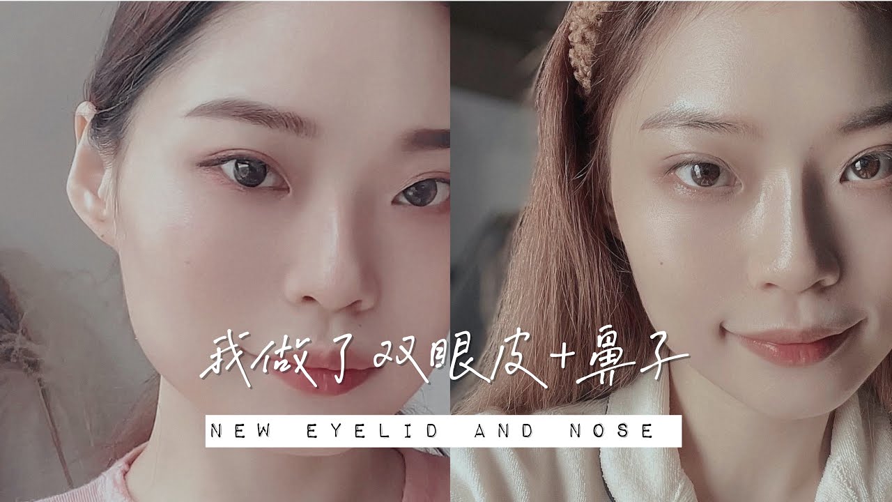 我做了我的双眼皮+鼻子｜ feat. BBLAB