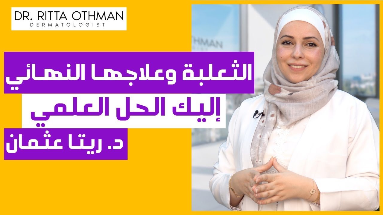 علاج الثعلبة بشكل نهائي 😍 👌| العلاجات الصحيحة للثعلبة