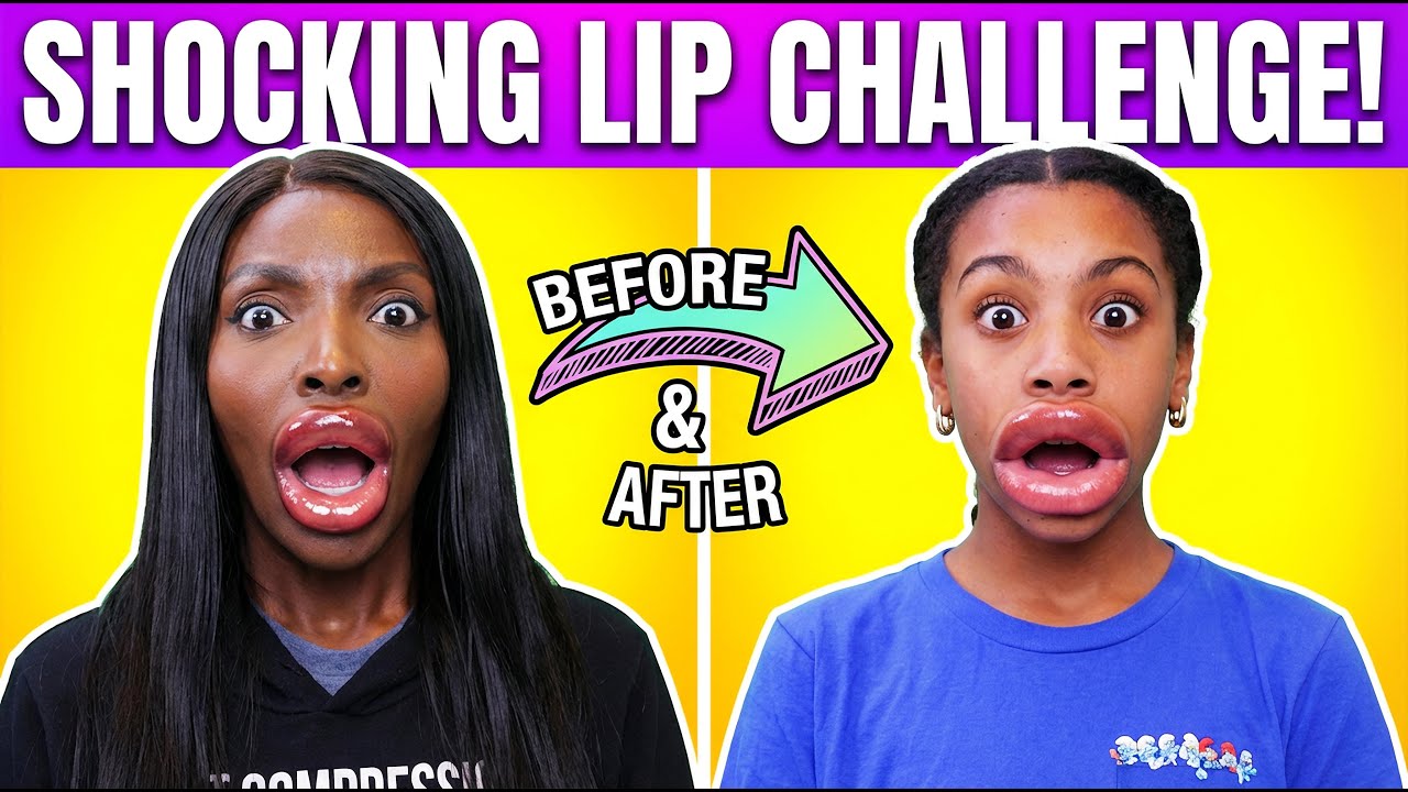 We Tried Lip Fillers For The Fist Time 😲