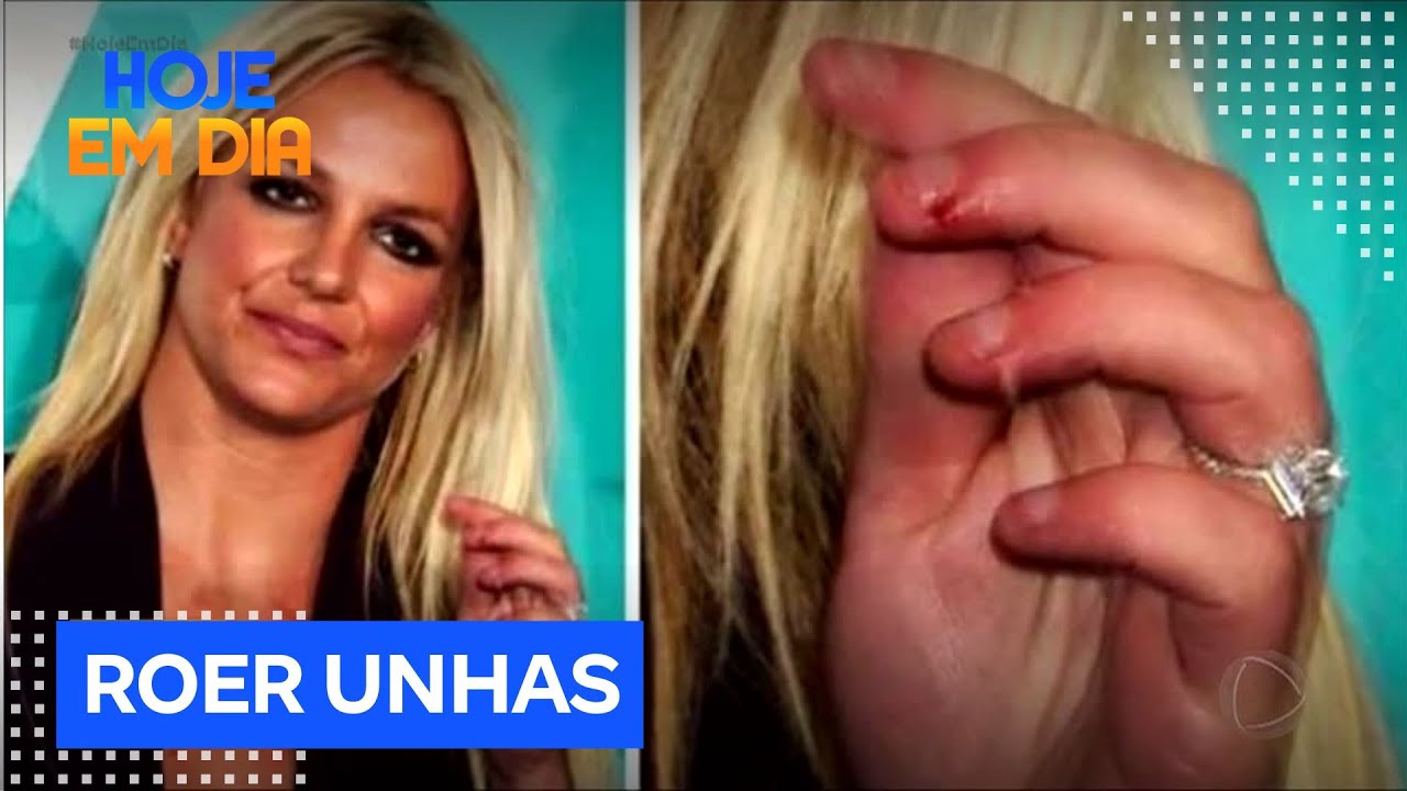 Hábito de roer unhas pode causar infecções graves, apontam especialistas
