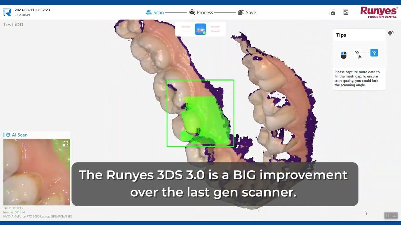 Runyes 3DS V3 Intraoral Scanner Review - Speed Test | iDD