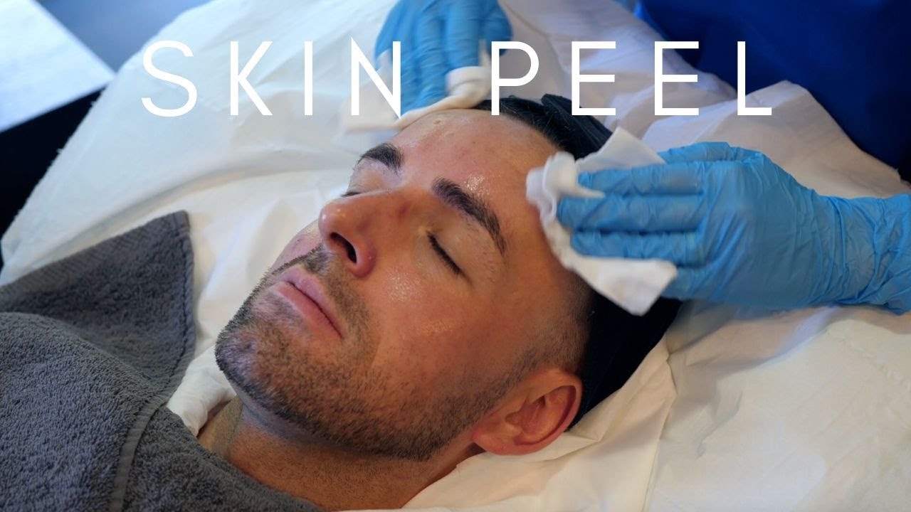 Obagi Blue Peel Radiance | The Laser and Skin Clinic