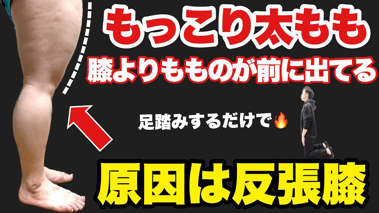 【たった2分足踏みするだけ】前ももの張りと脂肪燃焼する『反張膝矯正』