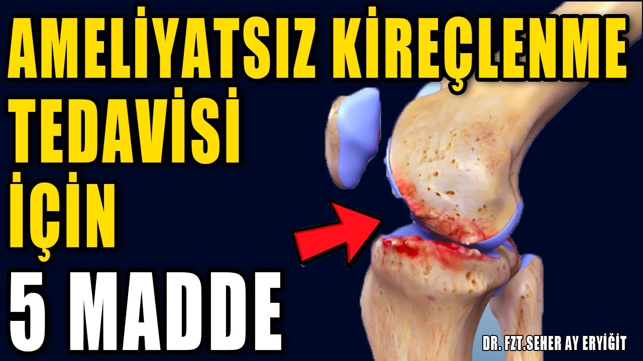 AMELİYATSIZ KIKIRDAK ERİMESİ TEDAVİSİ- 5 MADDE #aktifizyo