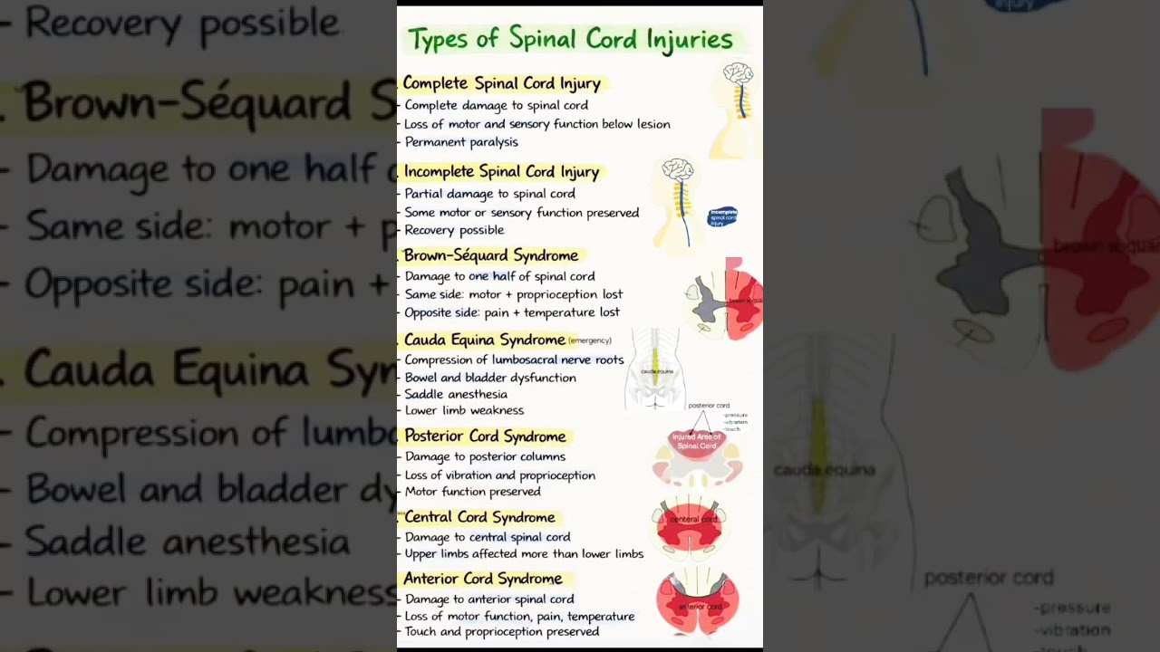 # type of spinal cord injury