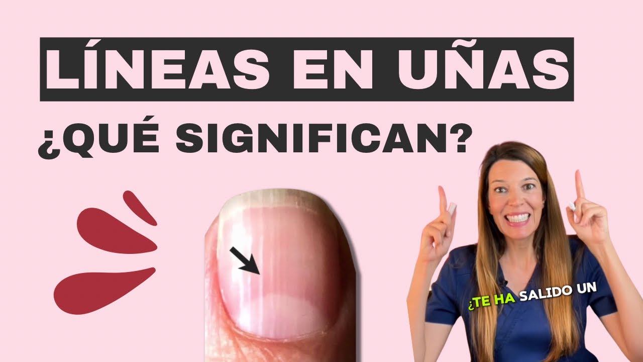 Líneas en las uñas: Dermatóloga lo explica.