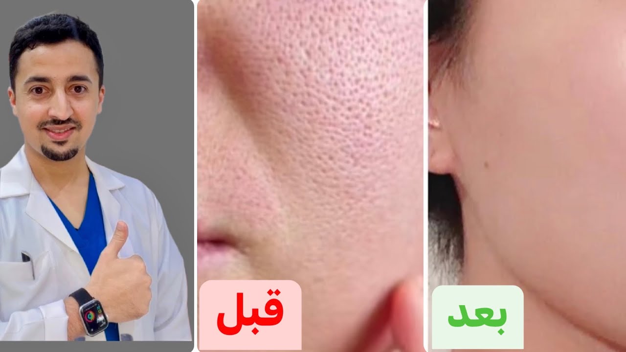 المسامات الواسعة بالوجه |  أفضل كريمات