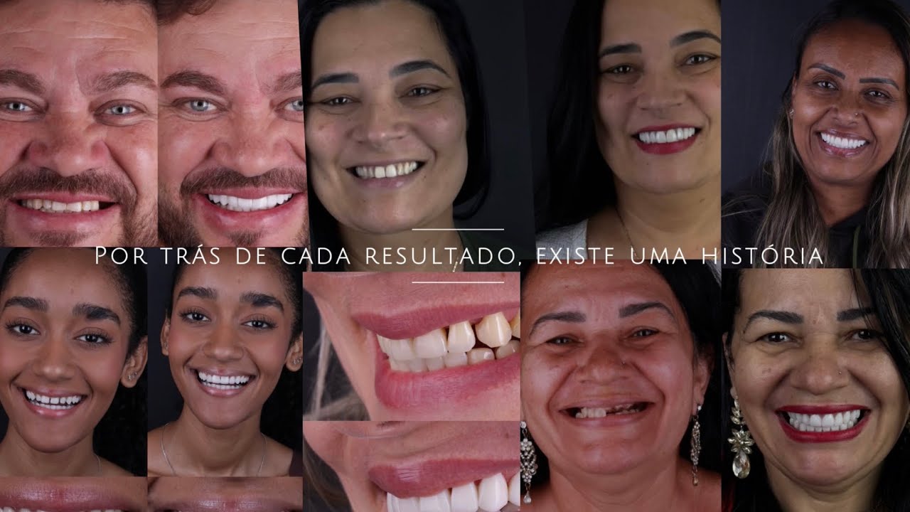 Dentarie Implantes | O Sorriso Que Todos Querem