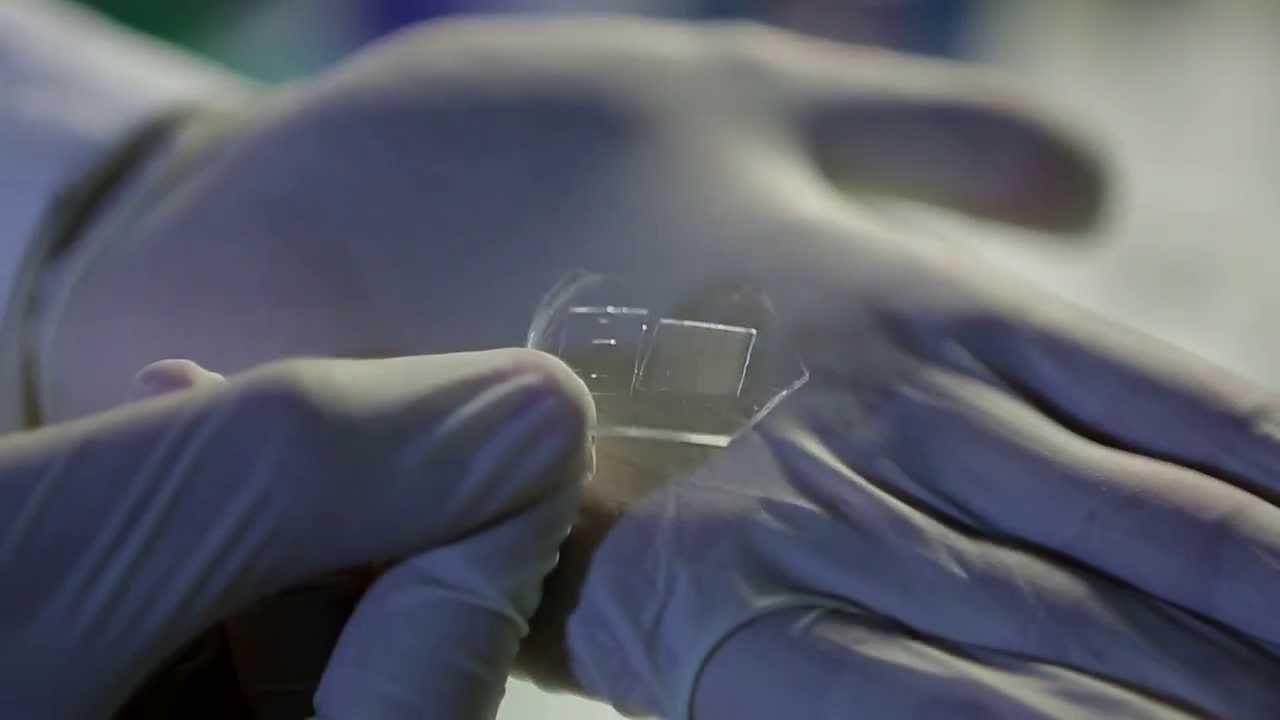 Spark Award 2014: Improved wound healing by structured cellulose patches