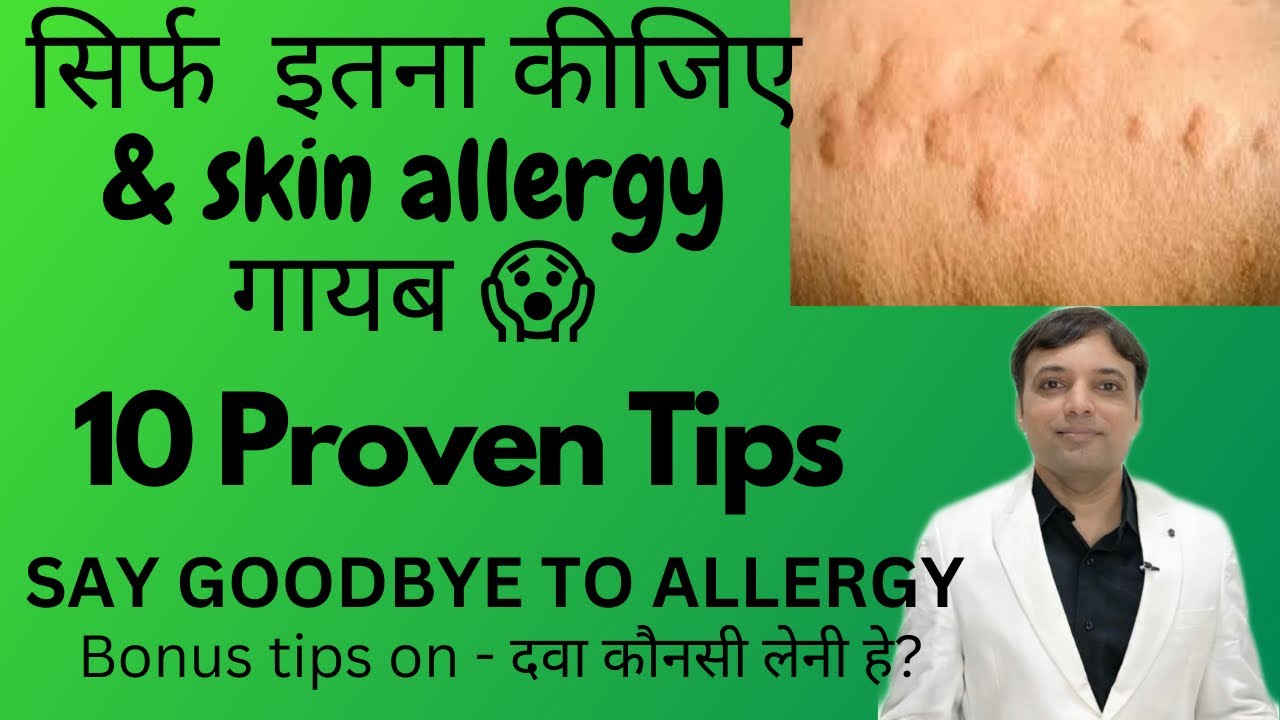 10 Tips for #Skin allergy treatment at home|स्किन एलर्जी को जल्दी ठीक करने की १० टिप्स Dermatologist
