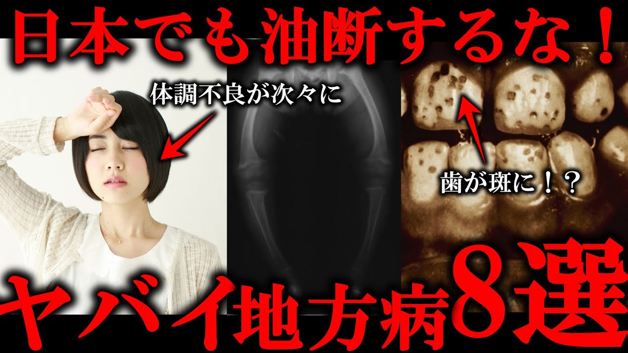 【 風土病 民俗学 】腹水、発作、骨の変形…実録！日本の地方病8選【 解説 Vtuber 天道巳弧 】